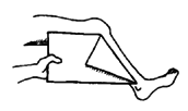 Measuring Contractures can be done by folding a paper and measuring the angle.