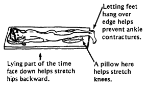 Lying part of the time face down helps stretch hips backward. Letting feet hang over edge helps prevent ankle contractures. A pillow here helps stretch knees