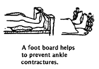 A foot board helps to prevent ankleb contractures.