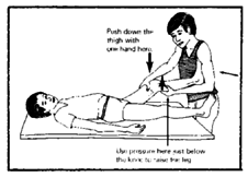 Stretching exercise for a bent knee.