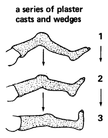 A series of plaster casts and wedges