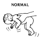 At birth - normal