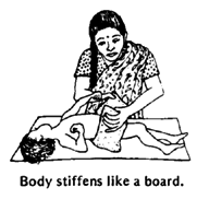 Body stiffens like a board.