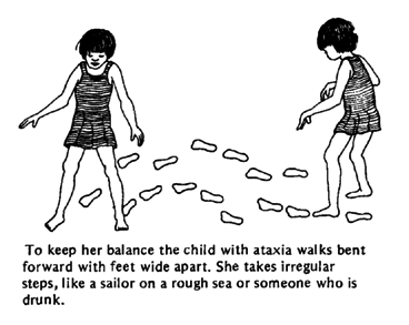 To keep her balance the child with ataxia walks bent forward with feet wide apart. She takes irregular steps, like a sailor on a rough sea or someone who is drunk.