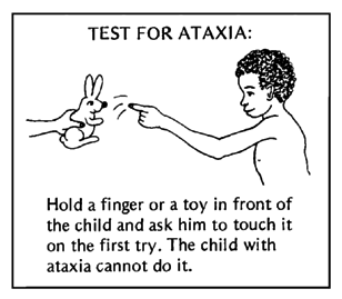 TEST FOR ATAXIA: Hold a finger or a toy in front of the child and ask him to touch it on the first try. The child with ataxia cannot do it.