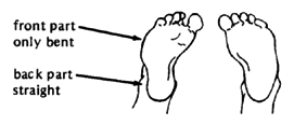 A baby's foot bent only front part and straight back part.