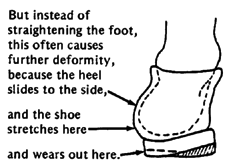 But instead of straightening the foot, this often causes further deformity, because the heel ides to the side, and the shoe stretches here and wears out here.