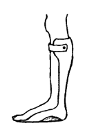 A brace that supports the foot and ankle.