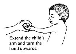 Extend the child's arm and turn the hand upwards.