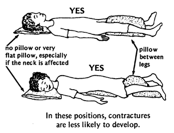YES: In these positions, contractures are less likely to develop.