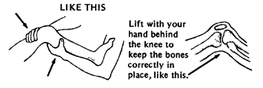 Lift with your hand behind the knee to keep the bones correctly in place.