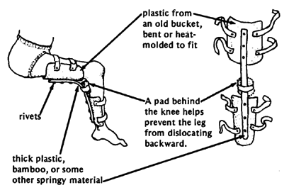 Knee method 1.