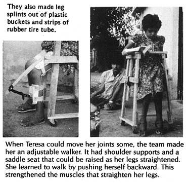 They also made leg splints out of plastic buckets and strips of rubber tire tube. When Teresa could move her joints some, the team made her an adjustable walker. It had shoulder supports and a saddle seat that could be raised as her legs straightened. She learned to walk by pushing herself backward. This strengthened the muscles that straighten her legs.