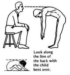 Look along the line of the back with the child bent over.
