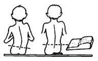 In a child who does not stand, check spinal curve while he is sitting.