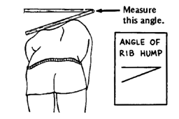 Measure the angle of the rib hump.
