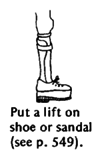 Put a lift on shoe or sandal (see p. 549).