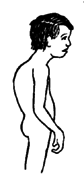 A child with rounded back