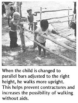 When the child is changed to parallel bars adjusted to the right height, he walks more upright. This helps prevent contractures and increases the possibility of walking without aids.