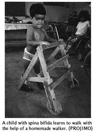 A child with spina bifida learns to walk with the help of a homemade walker. (PROJIMO)