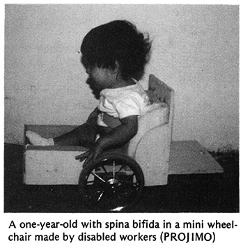  A one-year-old with spina bifida in a mini wheelchair made by disabled workers (PROJIMO)