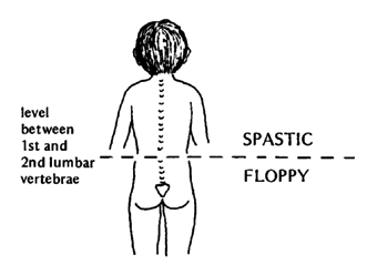 Level between 1st and 2nd lumbar vertebrae.