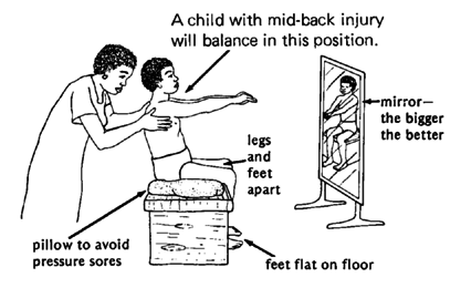 A child with mid-back injury will balance in this position.