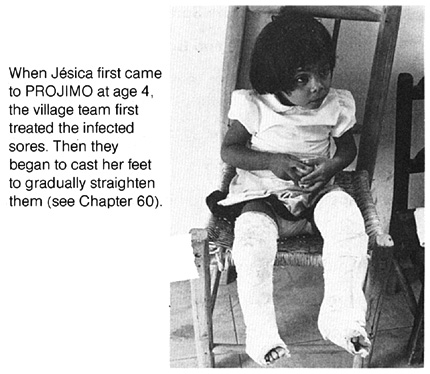 when jesica first came to PROJIMO at age 4, the village team first treated the infected sores.