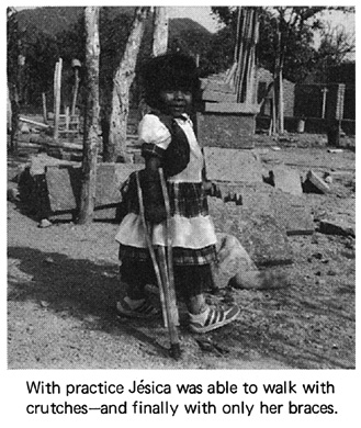With practoce Jesica was able to walk with crutches.