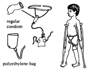 Regular condom, Polyethylene bag.