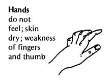 Hands do not feel.