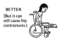 Better position (But it can still cause hip contractures.)