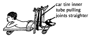 Car tire inner tube pulling joints straighter