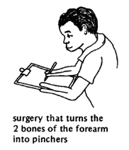 Surgery that turns the 2 bones of the forearm into pinchers.