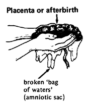 Placenta or afterbirth