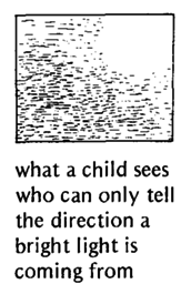 What a child sees who can only tell the direction a bright light is coming from.