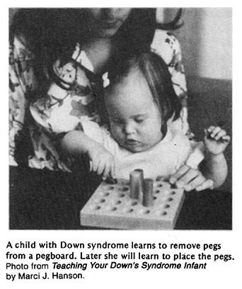 A child with Down syndrome learns to remove pegs from a pegboard.