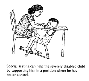 Special seating can help the severely disabled child.