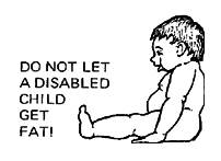 Do not let a disabled child get fat!