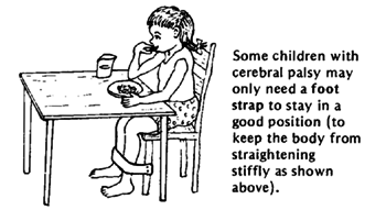 Some children with cerebral palsy may only need a foot strap to stay in a good position.
