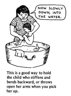 This is a good way to hold the child who stiffens and bend backward.
