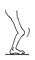 Stretching exercises to bend the foot up.