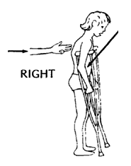 The crutch should be 2 or 3 fingers' width below the armpit.