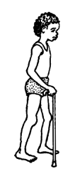 It works best to hold the cane on the side opposite the weaker leg.