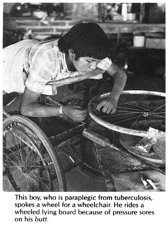 This boy, who is paraplegic from tuberculosis, spokes a wheel for a wheelchair.