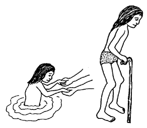 Walking in water will make it easier for her legs to support her weight.