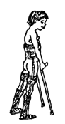 Body brace with leg braces