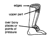 Soft padding (edges, upper part, over body places or points of pressure)