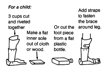 Plastic cup ankle braces - for a child