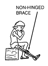 Non-hinged brace
